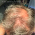 Kép 2/6 - Hey Joe! Anti Hair Loss Power Hair Lotion 150ml