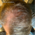 Kép 3/6 - Hey Joe! Anti Hair Loss Power Hair Lotion 150ml