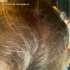 Kép 5/6 - Hey Joe! Anti Hair Loss Power Hair Lotion 150ml